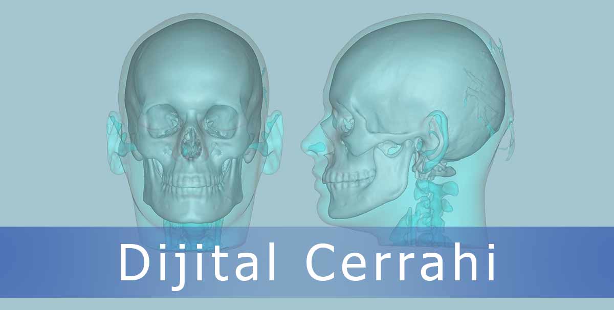 Dijital Cerrahi